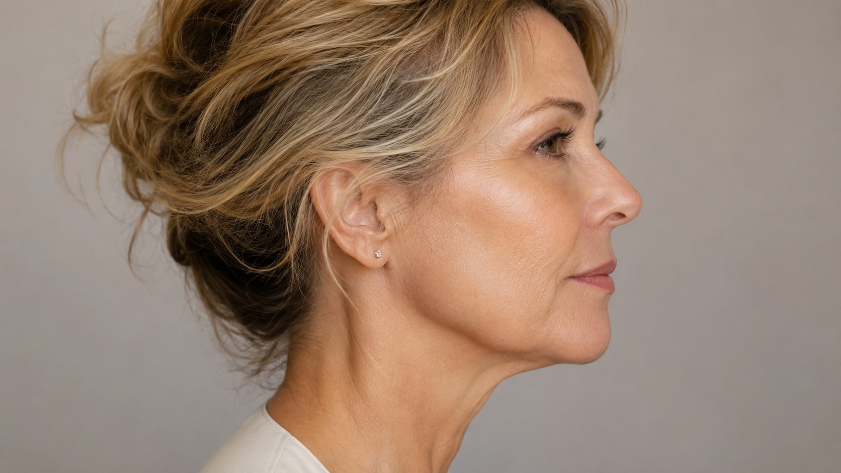 Jawline softening and facial aging after 40