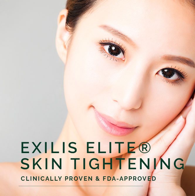 exilis elite skin tightening