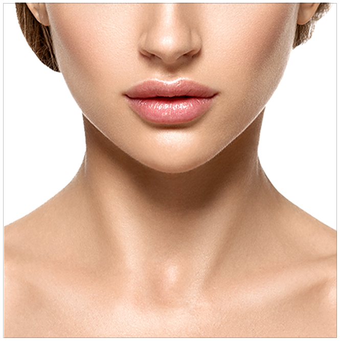 Chin filler-