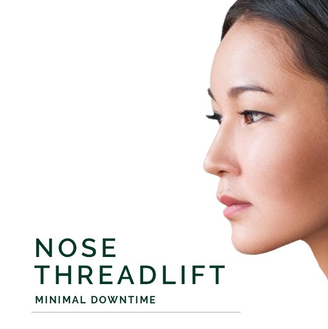 nose threadlift